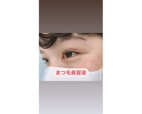 BB8CD794-7D3E-4FD7-B55A-189644D45F4D