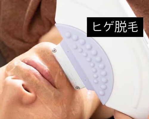 IMG_3928